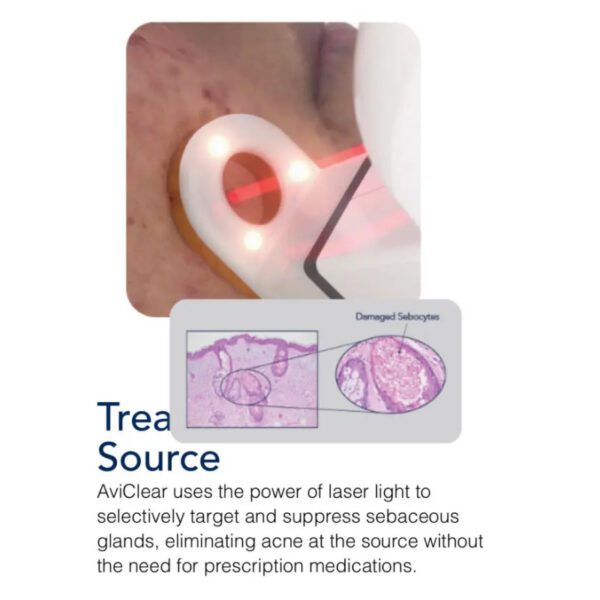 A treatment preview