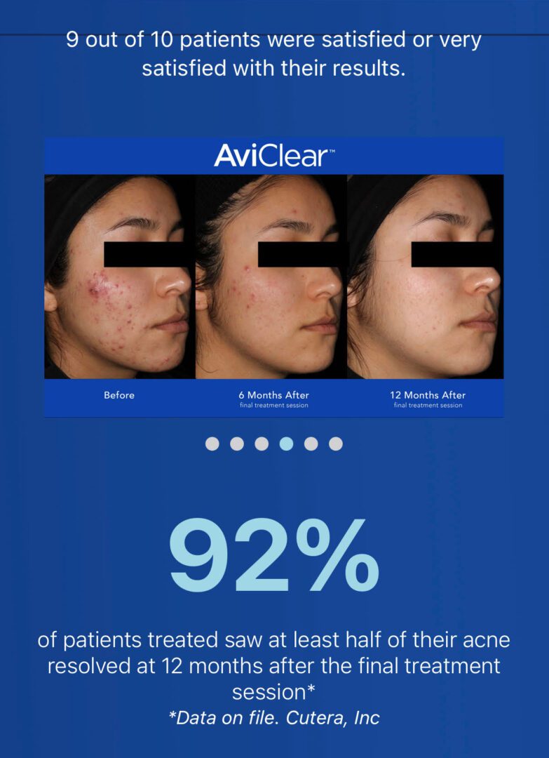 aviclear results1