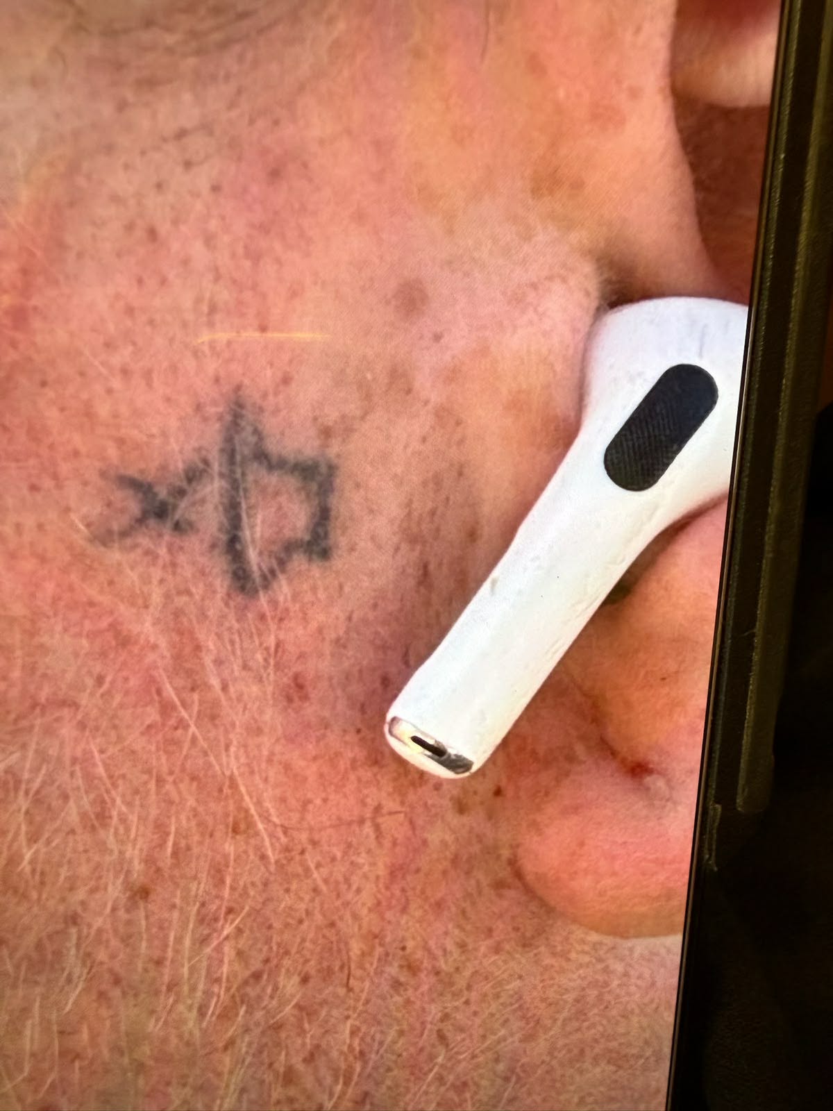 Before laser tattoo removal, neck and jaw tattoo