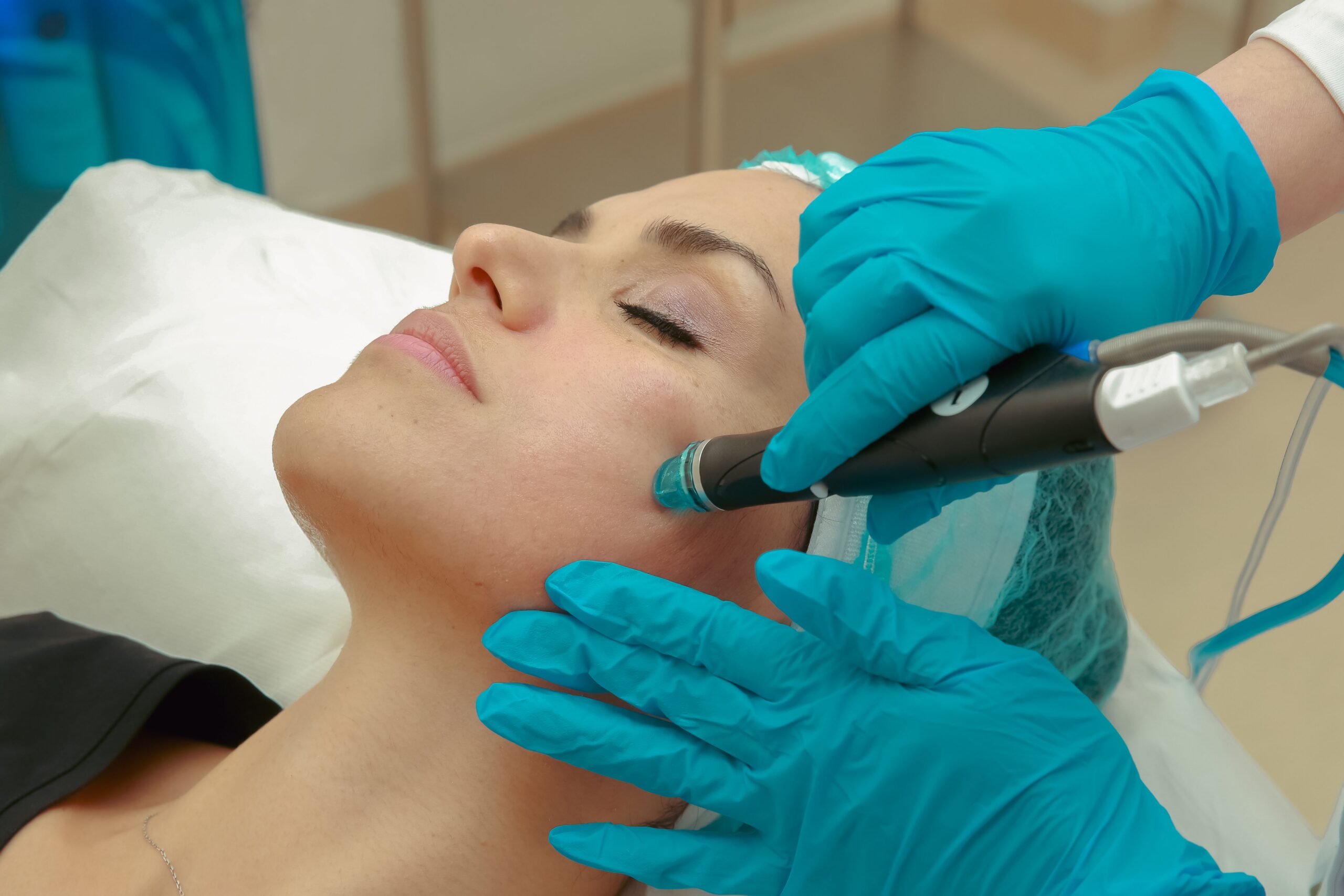Revance Glow microneedling facial