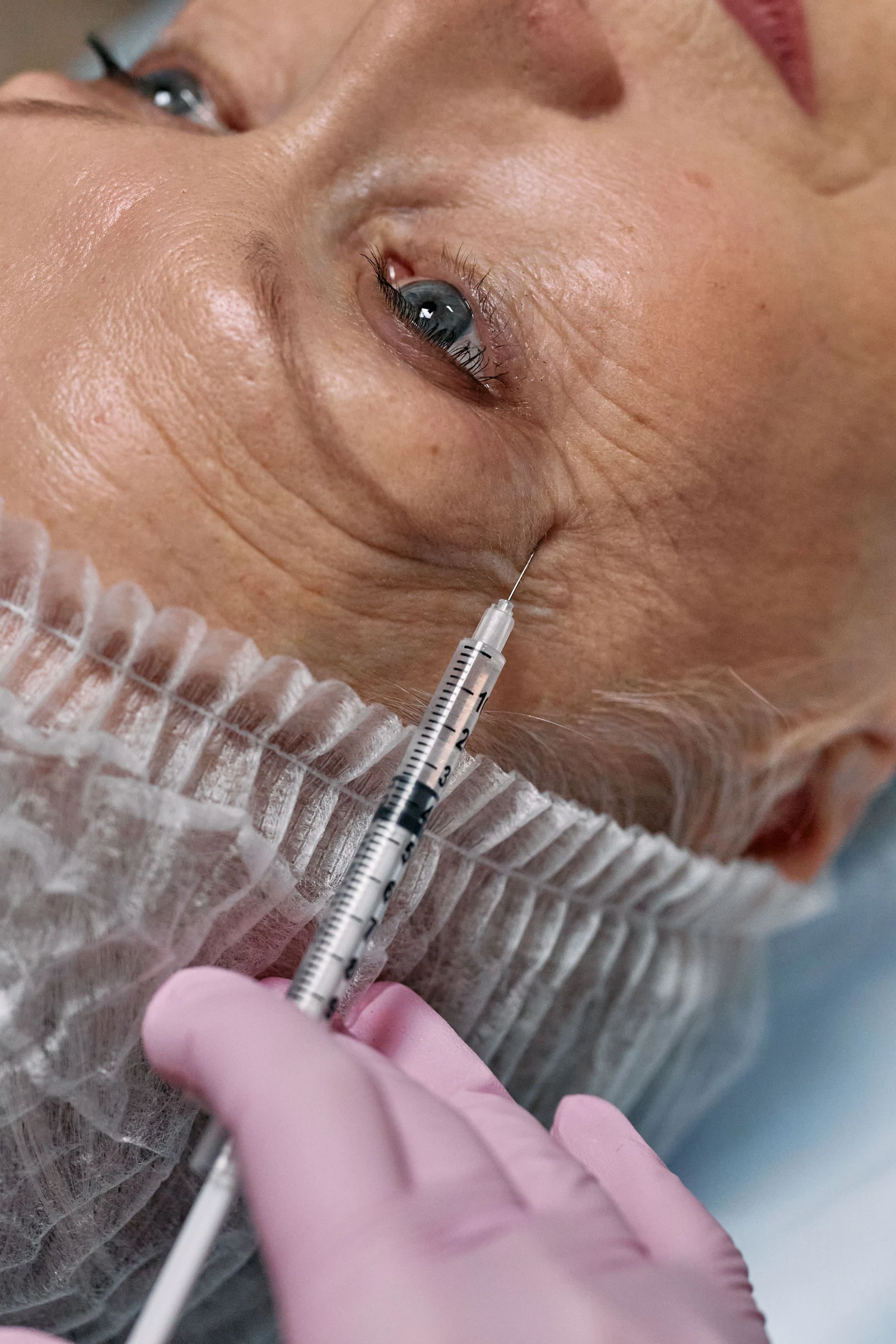 Botox sample image