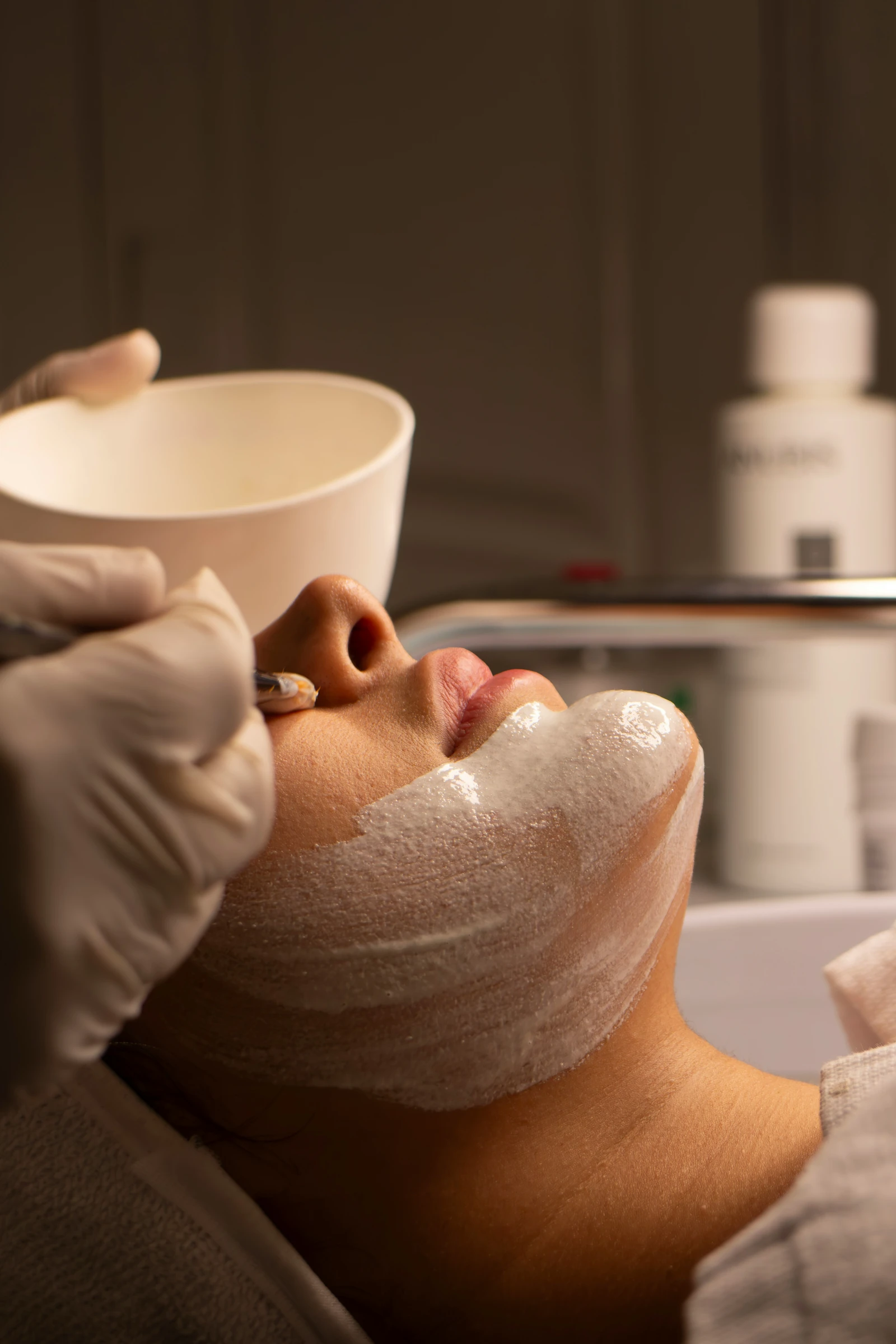 VI Chemical Peel treatment for brighter, clearer skin at Simply Bliss Med Spa
