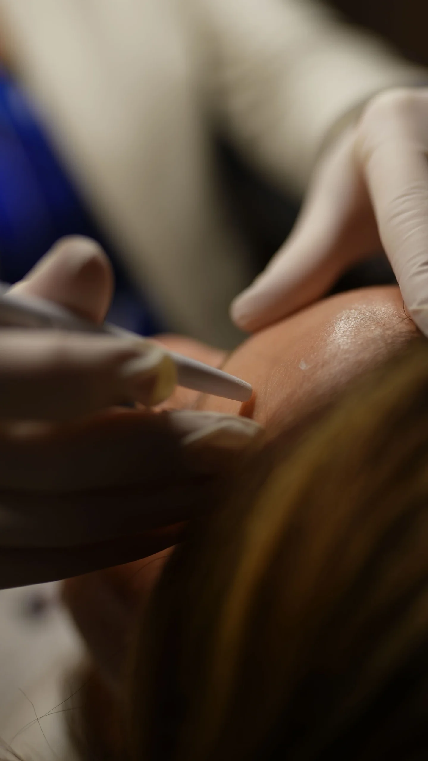 Microneedling plus PGDF October special